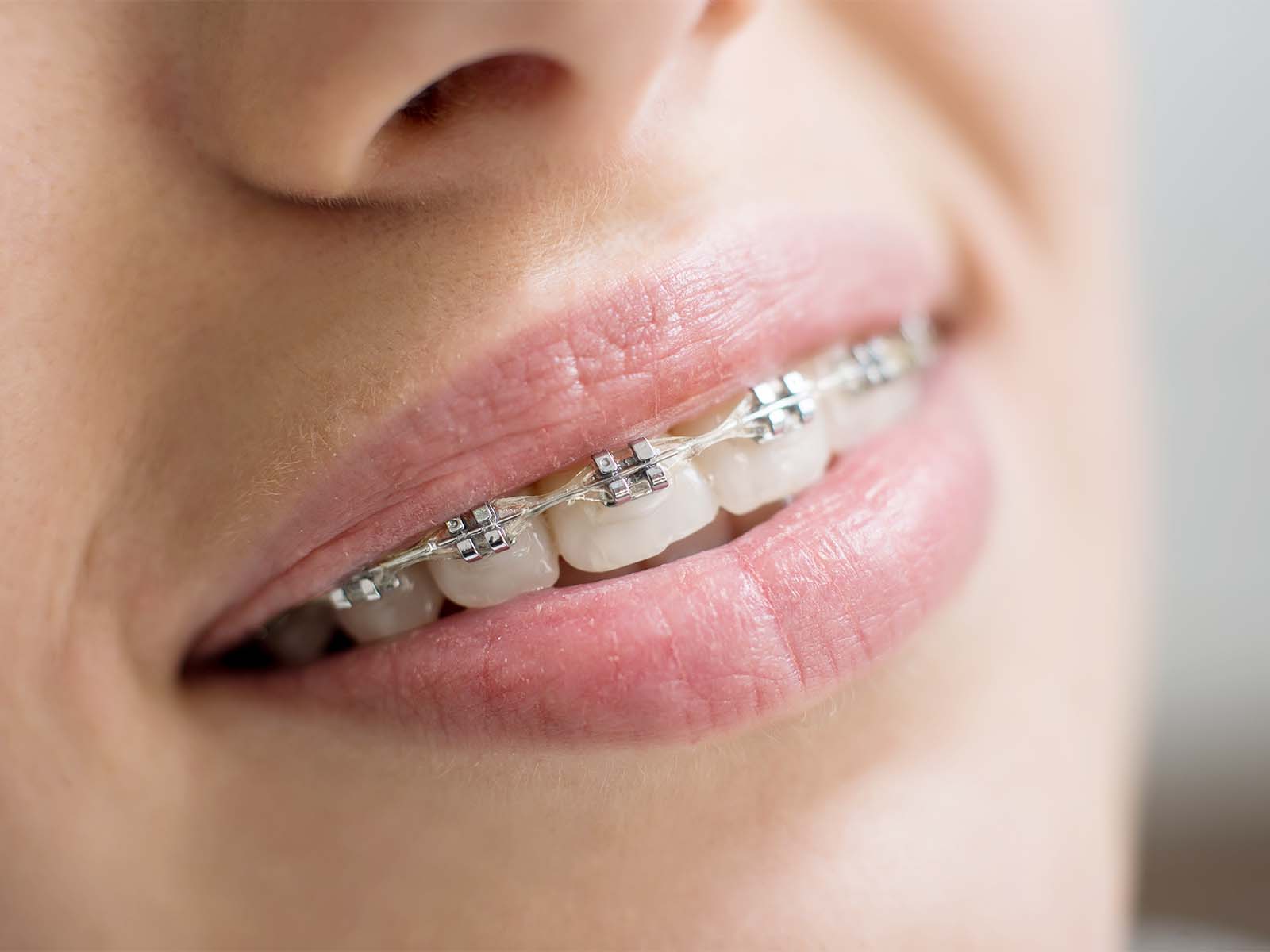 矯正歯科・小児矯正歯科